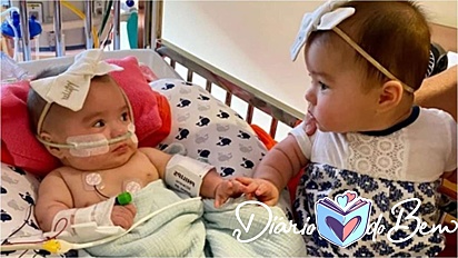 Gêmeas separadas por 200 dias devido à síndrome rara se reúne em foto comovente.(Foto: Instagram/childrensatl) 