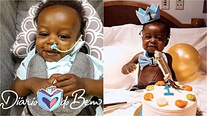 Bebê sobrevive ao Covid-19 e a um transplante de fígado antes de seu primeiro aniversário.